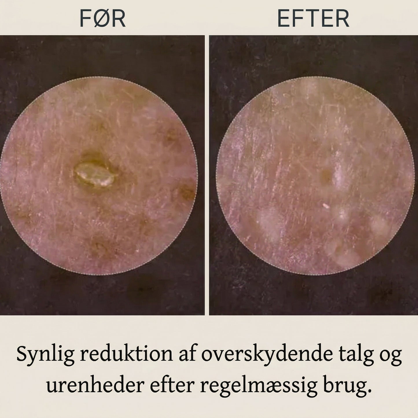 RillaMark™ PoreLift Rice Peel Serum – Synligt Renere Hud på Få Minutter