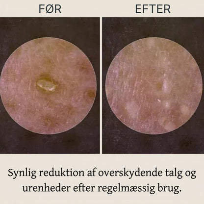 RillaMark™ PoreLift Rice Peel Serum – Synligt Renere Hud på Få Minutter